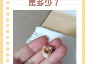 智齿拔一个还是拔一对？专家建议：一次性拔除同侧上下两颗智齿，避免分次拔牙带来的痛苦和风险