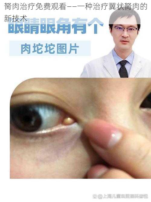 胬肉治疗免费观看——一种治疗翼状胬肉的新技术