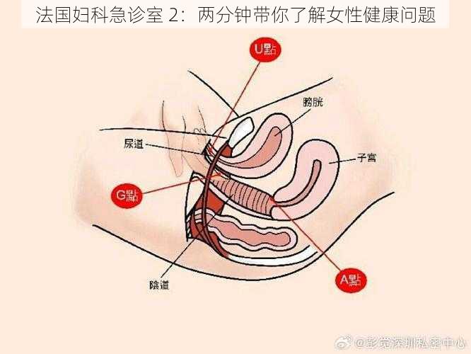 法国妇科急诊室 2：两分钟带你了解女性健康问题