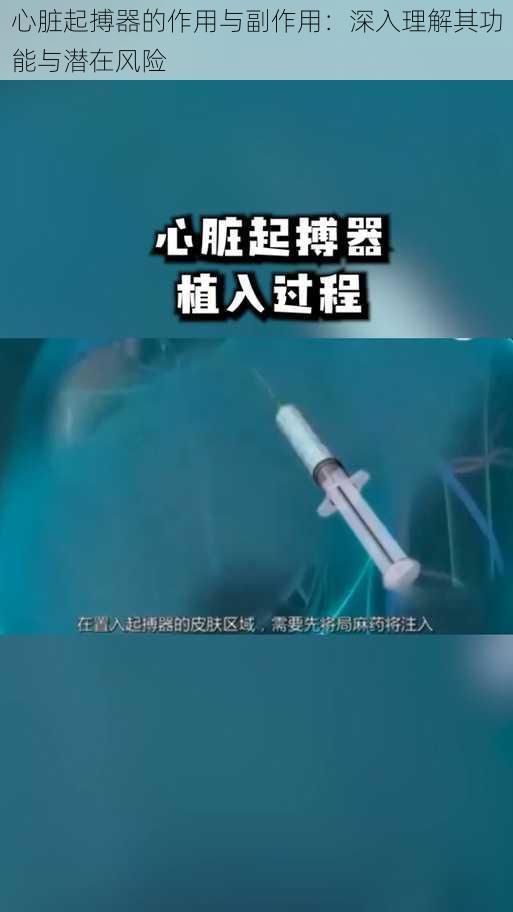 心脏起搏器的作用与副作用：深入理解其功能与潜在风险